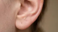 Perché c'è così tanto cerume nelle orecchie: la verità che nessuno racconta